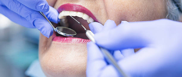 Best Emergency Tooth Extraction in Mulvane, KS